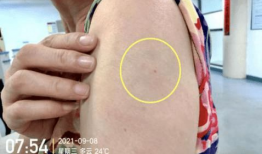 皮下针注射方法视频,视频教程详解